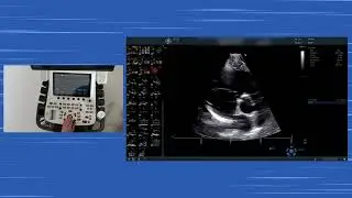 〖Echokardiografie〗 Parasternale kurze Achse Hands-on - Aortenklappe, Trikuspidalklappe & RVOT 💫🫀