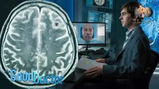 Dr. Shaun finds a tumor in Dr. Glassman's brain | The Good Doctor S6