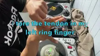 torn tendon cut session.......