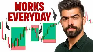 The ONLY Strategy You Need &mdash; The 20-Pips Day Trading System
