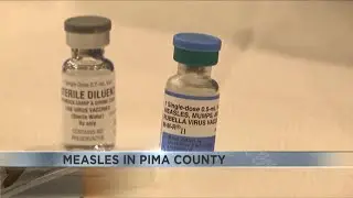 Pima County public health director provides details on confirmed measles case