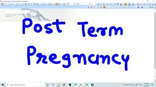 POST TERM PREGNANCY - CONCEPT; MANAGEMENT