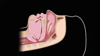 🫁 Ventilation Basics &ndash; CPAP vs BiPAP vs PEEP#norcet #rnkaur