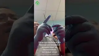 Кетгут-терапия (похудение) со скидкой 50%