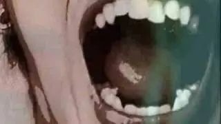 Keparat 