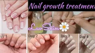 Nail Growth Oill Healthy Shiny StrongNails|| Grow Long Nails In 5 Days ||NailsFast||LuvSkin