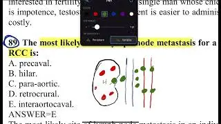 Right Renal lymph drain and the primary metastasis lymph node in RCC of Right kidney