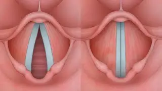 &iquest;Sabes c&oacute;mo funcionan tus cuerdas vocales?