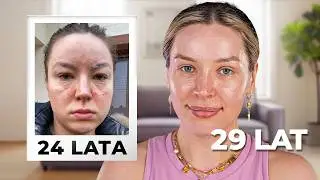 TOP 5 Tip&oacute;w na ŁADNĄ CERĘ! 🤩