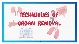 TECHNIQUES OF ORGAN REMOVAL  | AUTOPSY Part 3 | Postmortem Examination | FMT | Hindi