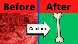Vitamin K2 takes Calcium out of your Arteries and into your Bones