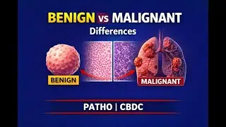 Benign vs Malignant Tumors | Differences Explained | Pathology | CBDC | MBBS BHMS FMG