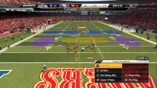 UBMurda187 VS leeanjilo W