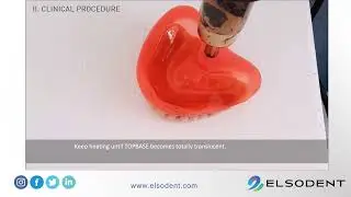 TOPBASE semi-definitive, hard relining of removable dentures