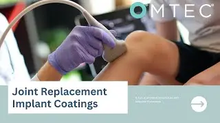 Joint Replacement Implant Coatings: A Focus on Metal Sensitivities and Infection Prevention