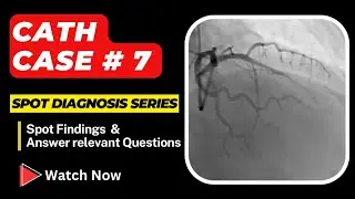 Cath Case 7: Spot Diagnosis Series - Cardiology TOACS