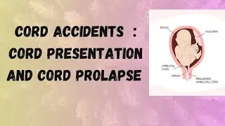 Cord Accidents - Cord Presentation and Cord Prolapse