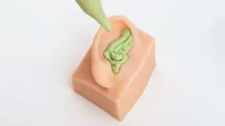 Toma de impresión de oído con Simulador Plan 3D