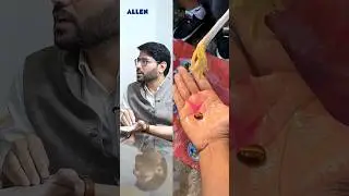 ₹1 Lakh Magic Stone Scam Exposed 😱 | Chemistry Behind the Trick #neet2026