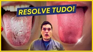 INFAL&Iacute;VEL!!! Como ACABAR com a L&Iacute;NGUA BRANCA e SABURRA LINGUAL! (SIMPLES E R&Aacute;PIDO)