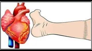 4 Major Heart Attack Red Flags You Need To Know
