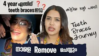 4 വർഷത്തെ കാത്തിരുപ്പ് 😳🦷പല്ലിൽ കമ്പി ഇളക്കാൻ പോണ് 😳💯#glamyganga 