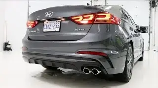 2017 Hyundai Elantra Sport Exterior | THE Most Complete review Part 1/6