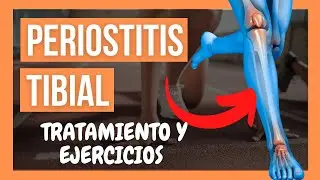 🦵PERIOSTITIS TIBIAL 💥 Qu&eacute; es, Causas, Ejercicios y Tratamiento