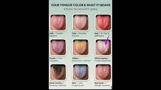 9 warning signs of your tongue according to colour || All medical students || #educationalvideo