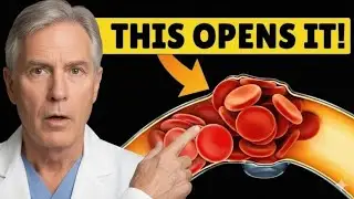 #1 Best Meal to UNCLOG Your Arteries (Backed by Science)