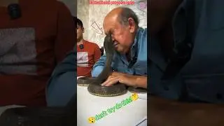 A Black Mamba Snake Bite the man Eyes | Most Dangerous Videos #snake #bite #deng #facts