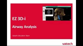Airway Analysis