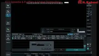 Registration and Scanning parameters