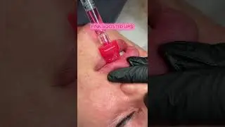 Pink Booster Treatment Explained: 7 Amazing Benefits, Cost & Real Results