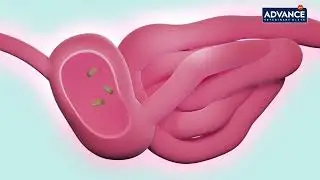 Advance Gastroenteric Dog 2024 EN