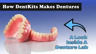 How DentKits Makes A Denture - A Look Inside Our 3D Denture Lab