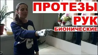 Бионический протез руки - первая примерка Bebionic©
