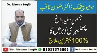 Phulbehri (Phalweri) Ka Ilaj | Leucoderma or Vitiligo Treatment | Dr. Rizwan Saqib | In Urdu/ Hindi