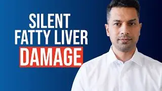 5 Surprising Fatty Liver Symptoms Hiding in Plain Sight
