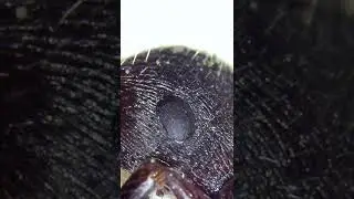Ant Eyes Under a Microscope 🔬