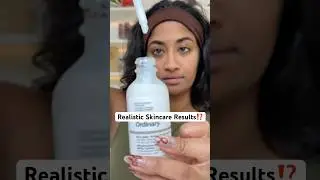 РЕКЛАМА | УХОД ЗА КОЖЕЙ НЕ ЯВЛЯЕТСЯ ЧУДОМ 😭 @theordinary #theordinarypartner