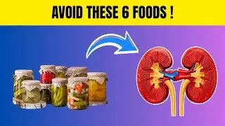 Avoid These 6 Common Foods That Secretly Destroy Your Kidneys Fast | Kidney Wellness 50+