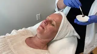 AlumierMD GLOW PEEL