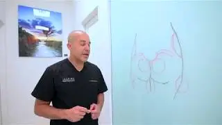 Let&rsquo;s talk about #brazilianbuttlift by Dr. Goodwin at Inspire Cosmetic Surgery