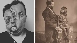 15 самых жутких цирковых артистов в истории