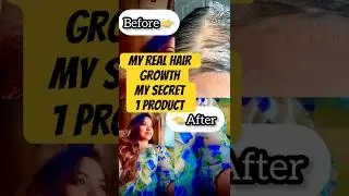 Best Hair Oil 💯for Hair Fall Control and Hair Growth &ndash; Trusted Formula #hairgrowth #hairstyle #hair