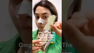 Omg 😱 I Tried The Nose Strips From Miniso To Remove Blackheads & This Happened 😰😫🤬