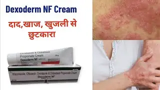Dexoderm NF Cream For fungal infection दाद,खाज,खुजली #fungalinfections  #dexoderm #treatment #खुजली