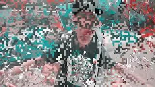 Naevus Flammeus von meiner Wenigkeit @trixxroyal7218 #fuegofunk #b2bsquad