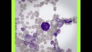 MAST CELLS/CELULAS CEBADAS (EL TESORO/THE TREASURE 27)